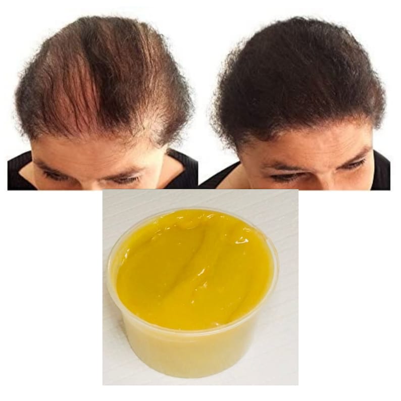 Super Growth Hair Grease, Grow Your Edges,Hair Growth, Thick Hair