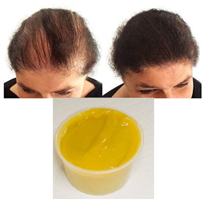 Super Growth Hair Grease, Grow Your Edges,Hair Growth, Thick Hair